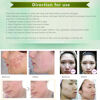 Mini-O3-Ozone-Therapy-Skin-Pores-Tightening-Acne-Treatment-Device_08.jpg